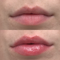 Thumbnail for Plump Up The Volume - Lip Plumper & Prep
